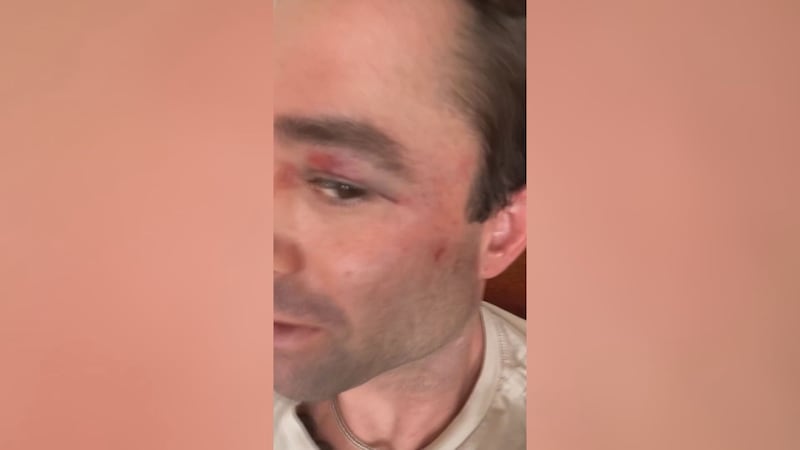 Former WJHG employee, current Fox News Meteorologist, gets attacked.